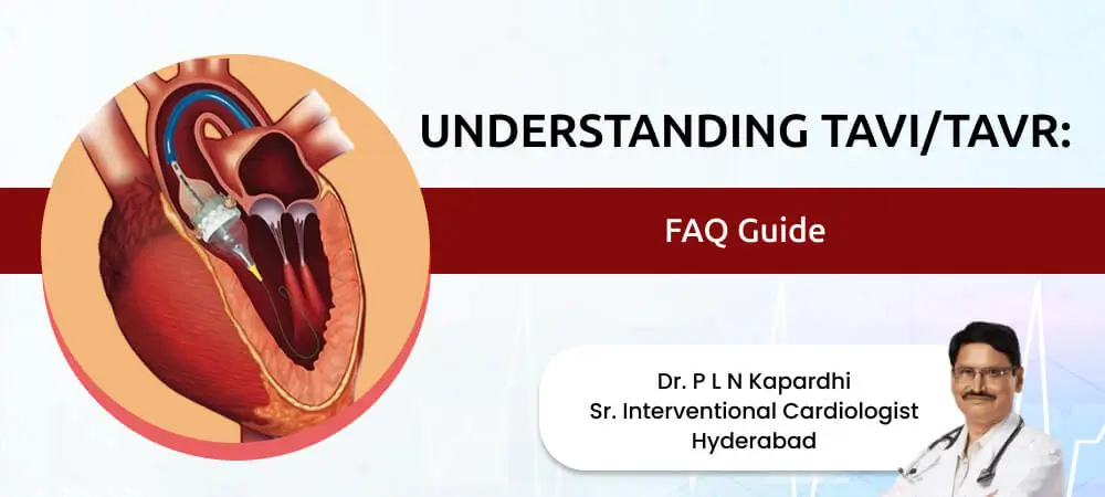 TAVI surgery treatment in Hyderabad by Dr. P L N Kapardhi